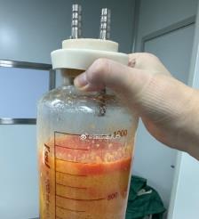 钦州水动力吸脂手术要做多久？